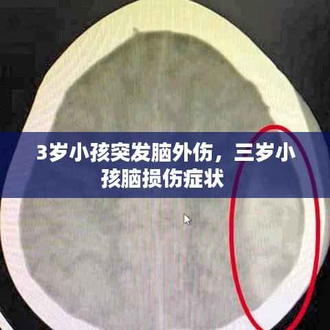 3岁小孩突发脑外伤，三岁小孩脑损伤症状 