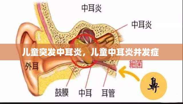 儿童突发中耳炎,儿童中耳炎并发症